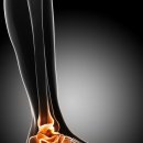 죽전튼튼정형외과의원 이미지