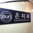 은치과의원 이미지