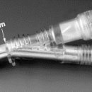 Intraoperative acute type A dissection caused by an intra-aortic filter (EMBOL-X?) in a patient undergoing mitral valve re-replacement for acute endoc 이미지