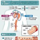 대동맥해리, 혈관이 터지고 극심한 통증이나 저림… 발병하기 쉬운 사람은？ 이미지