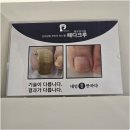 지행역 1번출구 앞 | 동두천 지행동 발각질 벗겨진다면 여기 가보세요! 네일애반하다