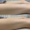 제이아우룸&스킨52