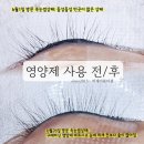 비제이뷰티 | 빠른 속눈썹영양제 효과 고객님사용 전/후 비교 대구 성서 이곡동 비제이뷰티샵