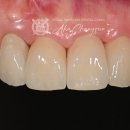 솔라움치과기공소 이미지