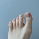 원레이져 | 강남 발톱무좀 병원 1만원 체험 내돈내산 솔직후기 드릴케어부터 레이저 치료까지