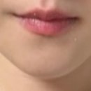 휴(Hue) 덴탈랩 | 2025 11 Sydney Day 1 &amp; 2