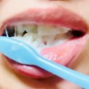 이치덴탈 | 입병원인 이것만 바꿨더니 반복 덜하더라고요ㅜㅜ (팩폭 후기, 민감러 필독!)