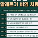 소아 알레르기성비염 증상 방치하면 만성 비후성비염 이미지