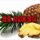 파인애플