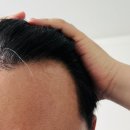 지성홈페어 | 다이소 추천템 모제림 가성비 두피앰플 탈모관리 꿀템 발견