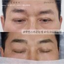 스칼프랩앤뷰티