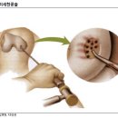 (유)심신통합면역연구소 | 무릎골관절염 시장 패러다임 변화