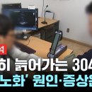 [일반] 접종자들 급노화 이미지