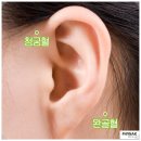 스위스보청기 이미지