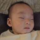 동산병원 | 대구동산병원::담이의 귀 교정 후기(시기, 방법, 비용)