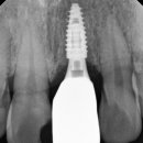 신원치과기공소 이미지