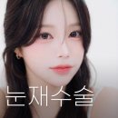 풀림과편안 | 재수술잘하는곳 리얼리가 알려주는 쌍꺼풀재수술후기로 보는 반복되는 쌍꺼풀 풀림, 재수술 전 체크포인트?
