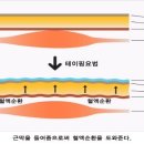 날씬한 종아리!! 다이어트 테이핑 이미지