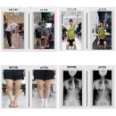 야베스메디 이미지