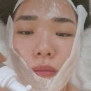 뷰티진스킨케어 | 학동역스킨케어 노바뷰티샵 진정관리 한 번으로 피부톤이 맑아진 후기