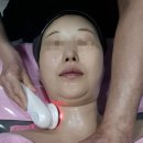 윤곽 | 메디결라인 윤곽관리 후기