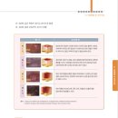 6. 욕창예방 및 관리지침 이미지