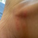 우리윤약국 | 보홀 13일차(알로나_안드레아스, 갈릭레몬, 머리땋기, 아이스 플레이크) (탁빌라란_ICM몰)