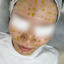 피부미인화장품 | 부천 리움뷰티에서 바이오리필 필링 받고 피부 미인 등극! 후기 공유