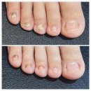 풍어관 | 목포무좀발톱으로 고민이라면 관리 잘하는 곳으로 가야지