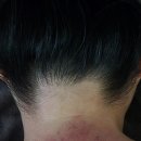 왁싱ON | 천안웨딩왁싱 성성동 '온담왁싱' 뒷목 슈가링왁싱 후기