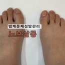 노브 | 범계 문제성발관리 무좀 내성발톱 케어 잘하는 노브살롱 후기