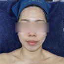 나은뷰티 | 춘천 피부관리샵 추천 더나은뷰티 콜라겐관리 후기