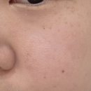 542 | 피부결정리 :: 뮤즈542 바이아토 시카 스킨패드 결트키패드 후기