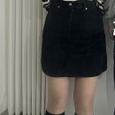 다리지방흡입 5주차 내돈내산 후기 (비포&amp;애프터, 부평비만클리닉 가격)