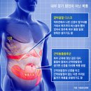 척추 압박골절·대상포진… 이미지