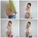 라이프닝 딥톡스 플러스 효과!! 다이어트 하자!!