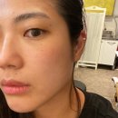 힐탑세탁소 | 광안리 피부관리 하리안 뷰띠끄, 윤곽관리로 수기경락 받기