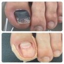 엠블케어 이미지