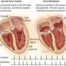 심방세동 Cardiovascular / Pharmacist Noh 이미지