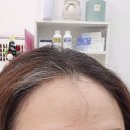 리리클헤어