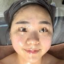 아라약국 | [아라뷰티케어] 물광피부 되는 하남 피부관리 / 윤곽관리 에스테틱 후기