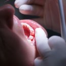 서울J플란트치과의원 이미지