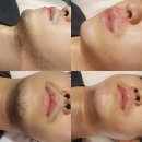 스칼렛왁싱