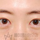 풀림