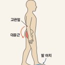 [전주에코시티/전주PT]고관절이 좋아지면 발(아치)이 살아나는 이유