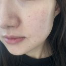 지성소프트 | 피부 장벽 꽉 잡는 주닥 인텐스 모이스트 비5 소프트 크림 솔직 후기