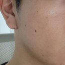 수원피부관리 남자피부관리 드레브스킨 해초필 후 재생관리 내돈내산 후기