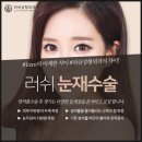 태성형외과의원 네이버블로그