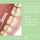아름드리기공소 네이버블로그