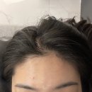 강남왁싱샵 빅토리아왁싱 헤어라인왁싱 후기